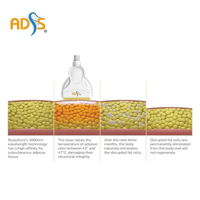 1060nm Cryolipolysis que adelgaza el laser del diodo de las manijas de la máquina 4 que adelgaza la máquina