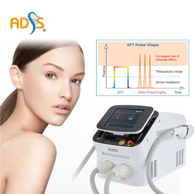 Máquina sin dolor del OPT Elight IPL, máquina del laser de la vena de la araña