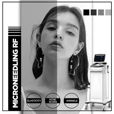 Máquina de Microneedling de la radiofrecuencia, máquina de Thermolift para el salón del balneario